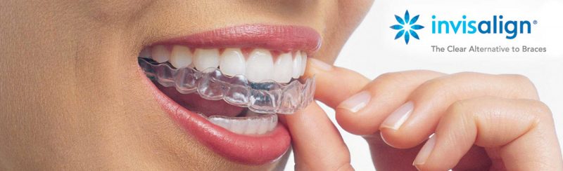 Equipo de dentistas en clínica dental Soto de la Moraleja