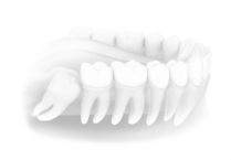 cirugia bucal